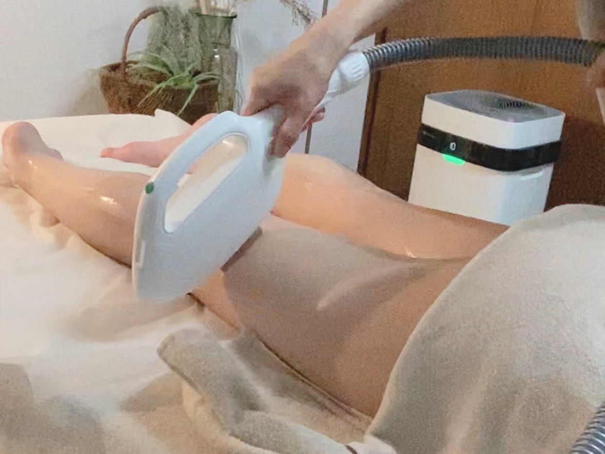 脱毛施術の様子